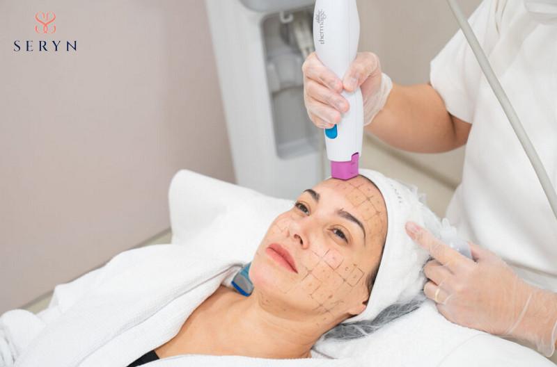 Phương pháp sử dụng nhiệt lượng trẻ hóa vùng trán hiệu quả 