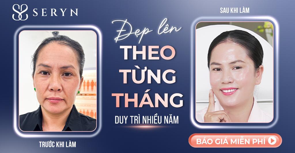 Hiệu quả vượt trội của SERA CORE trong việc xóa nếp nhăn tăng thêm thần thái, giữ trọn SẮC và THẦN gương mặt 