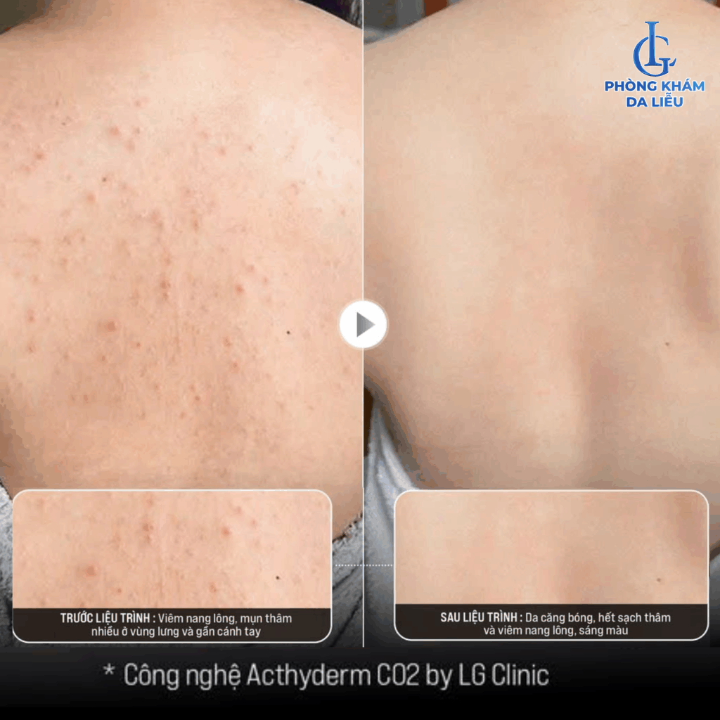 Kết quả điều trị thực tế do khách hàng chia sẻ