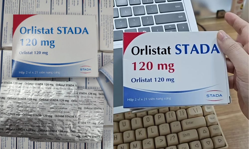 Những Điều Cần Biết Trước Khi Dùng Orlistat 120mg Stada